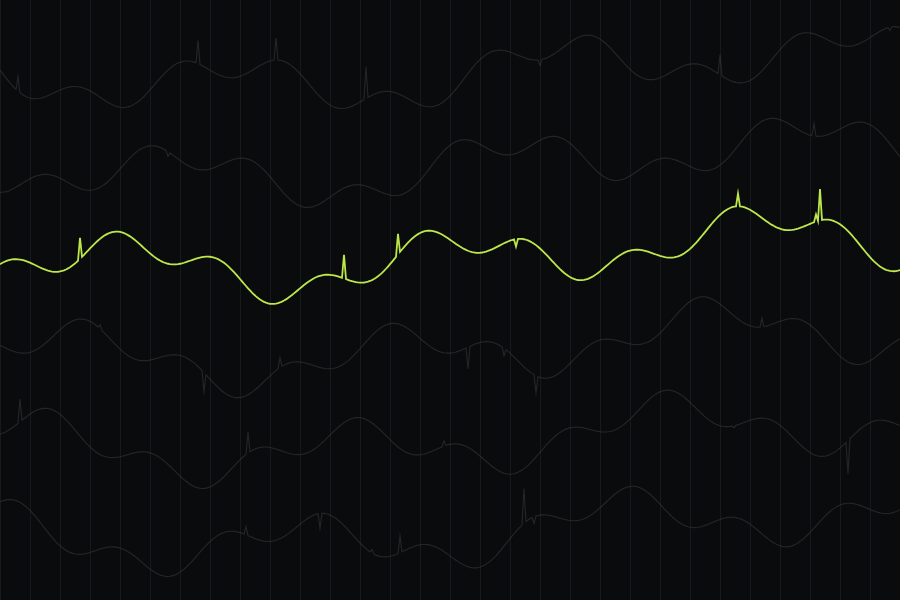 Stacked telemetry traces